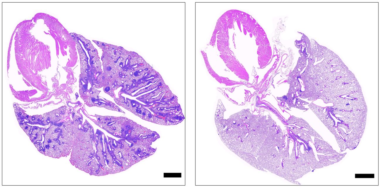 20240530-lung.jpg Cross-sections of lungs from mice with the gene deficiency that causes APS-1, showing damaged tissue in mice not administered ruxolitinib (left) and healthy tissue in mice administered ruxolitinib (right) Black bars represent 1 mm.