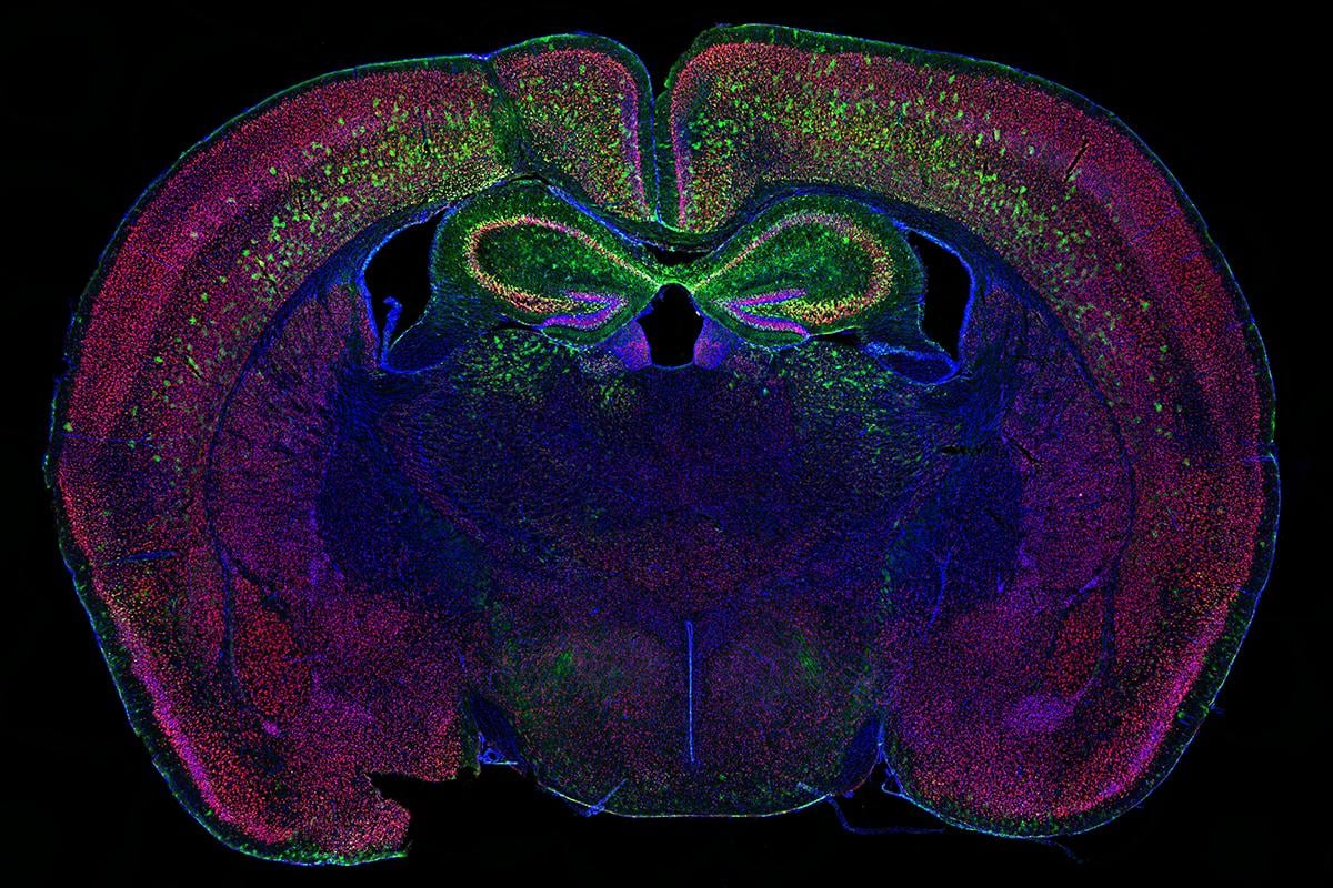 a slice of mouse brain tissue displaying neurons (red) and cell nuclei (blue)