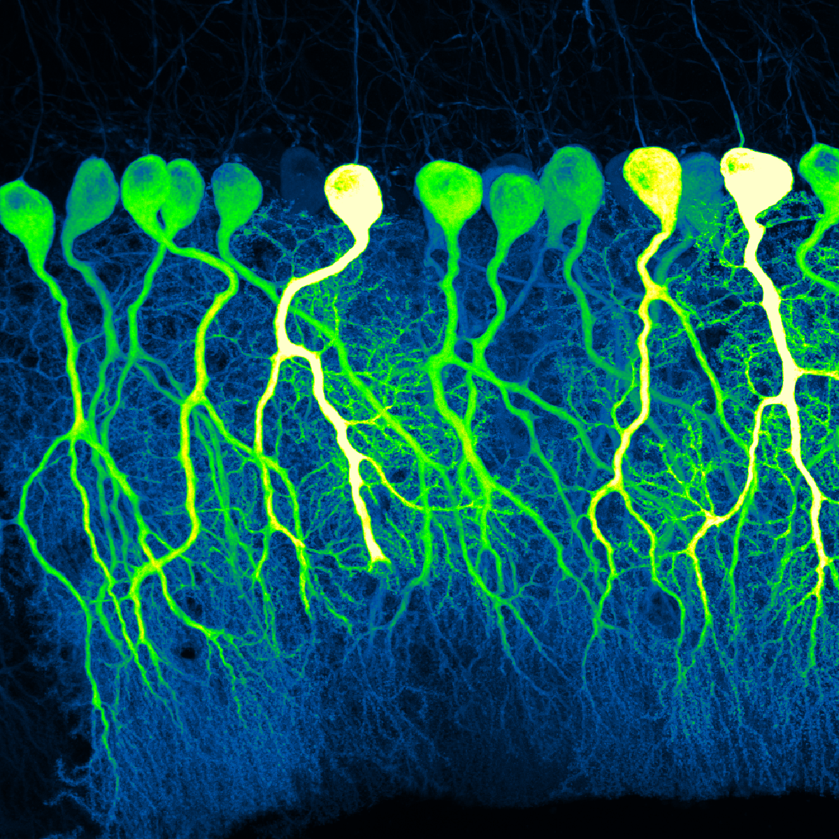 Purkinje cells in the mouse cerebellum