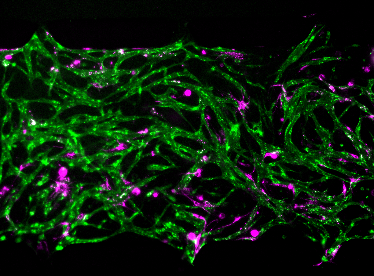 A ampliação de um chip de medula óssea projetado inclui uma rede de vasos sanguíneos marcados em verde e manchas de nichos celulares marcados em magenta