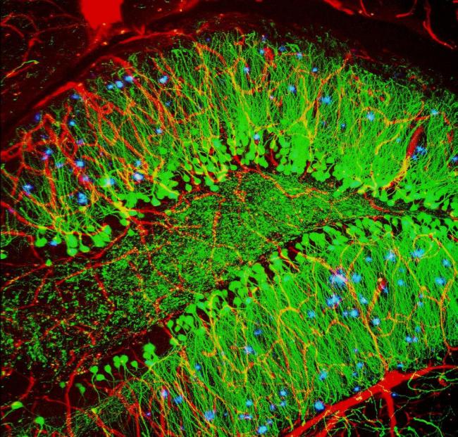 Mouse model of Alzheimer's disease