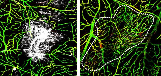 Images of brain blood vessels one and seven days after head injury