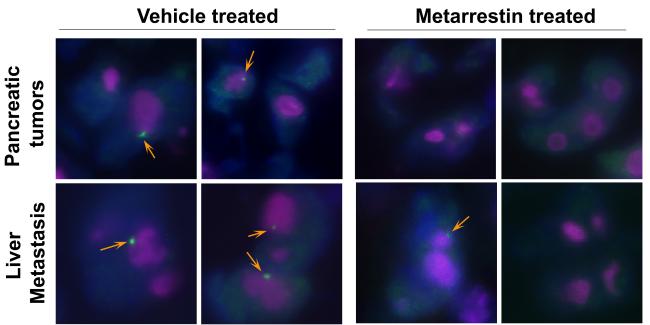 A compound breaks down a component of cancer cells.