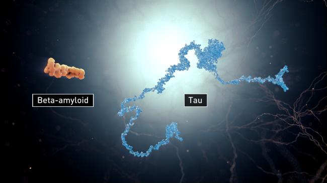 Illustration of Beta-amyloid and tau