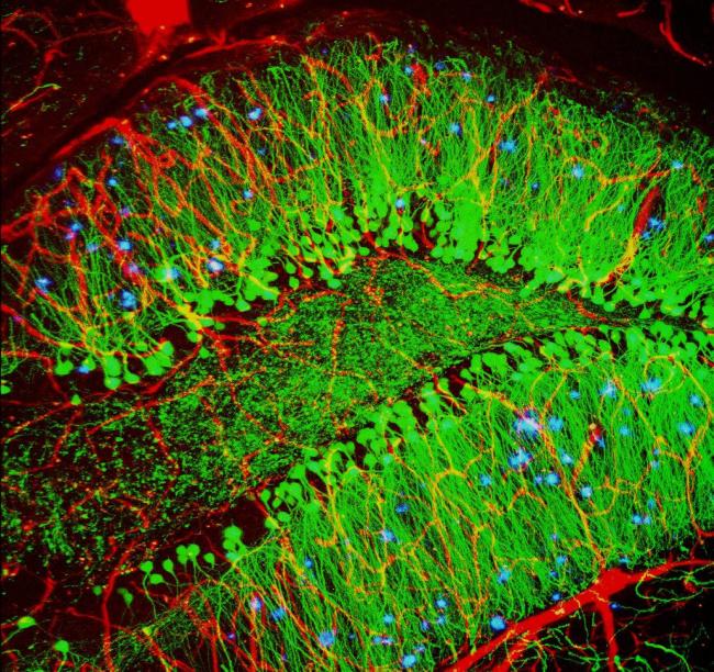 Mouse brain with hallmarks of Alzheimer’s disease