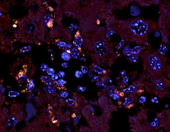 20180327-fish-liver.jpg A microscopic image of liver tissue with bacteria