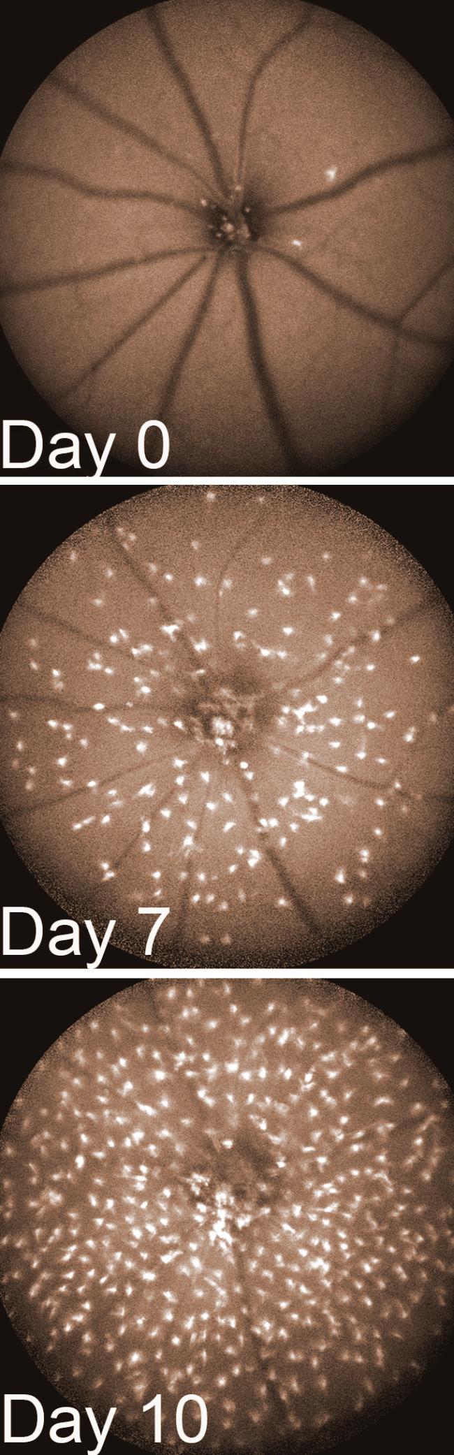 Three images of a retina show increasing number of immune cells on days 0, 7, and 10