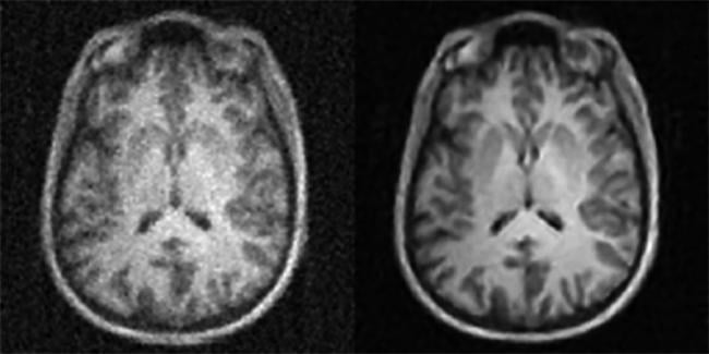  Brain images