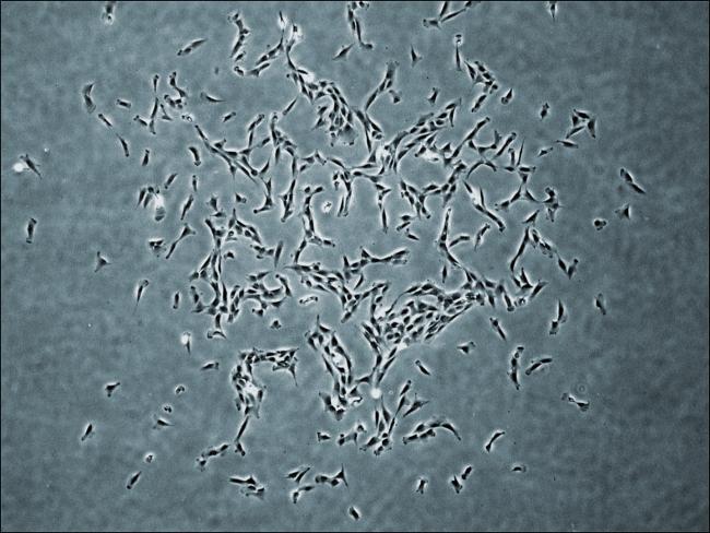 Human skeletal stem cells