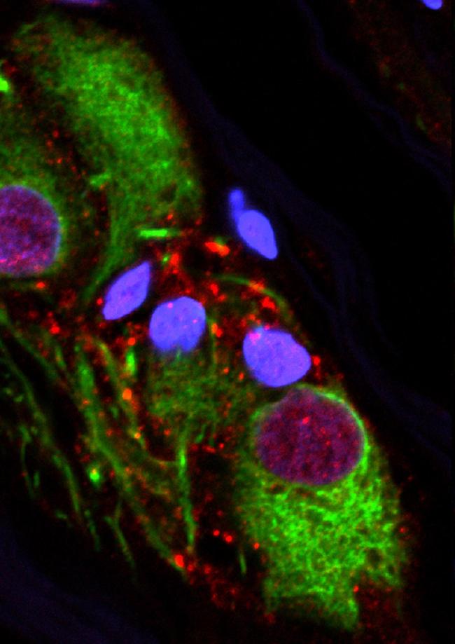 Alpha-synuclein in the appendix