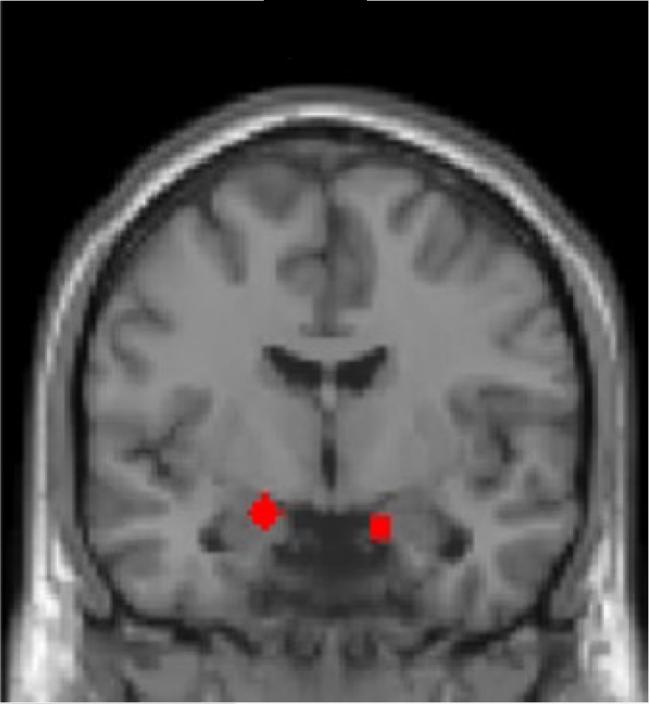 Image of a brain scan