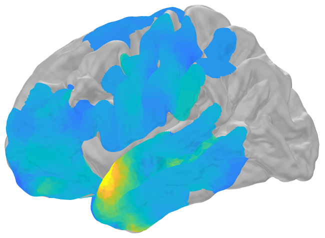 20190315-memories.png Computer-generated brain scan.
