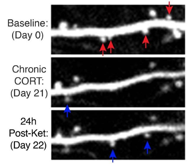 Dendritic spine remodeling