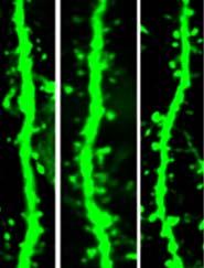 20190430-ketamine.jpg Dendrites with spines