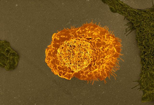 Colorized scanning electron micrograph of a macrophage