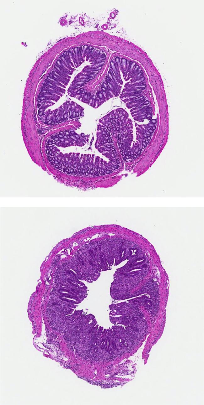 20190827-autoimmune.jpg Sections of mouse colon tissue