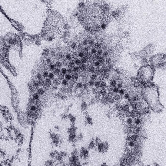 20190827-entrovirus-blue.jpg Electron microscope image revealing numerous, spheroid shaped EV-D68 virions