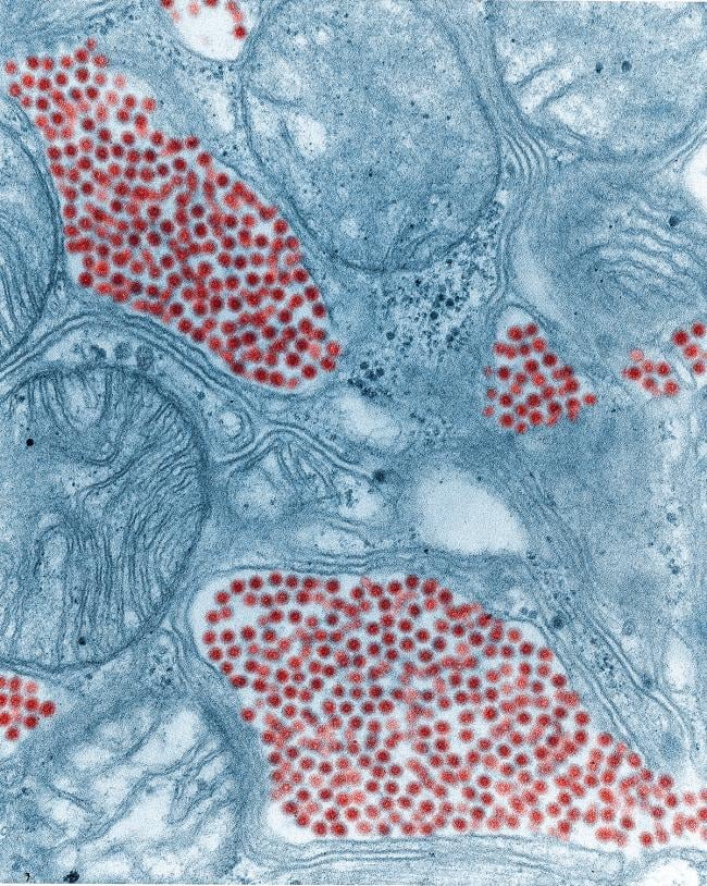 Eastern equine encephalitis virus poses emergent threat, say NIH ...
