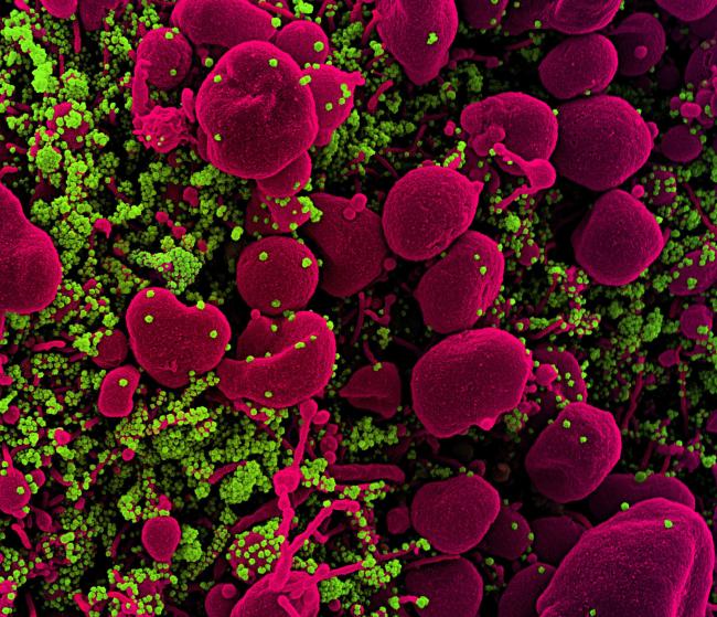SARS-COV-2 virus particles