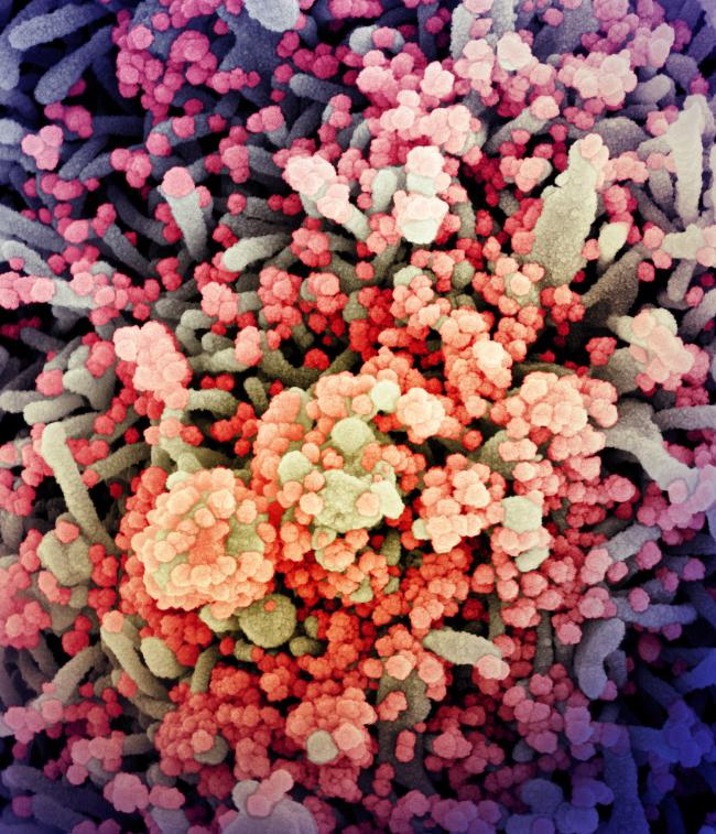 SARS-CoV-2 virus particles