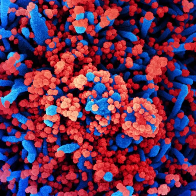 20201109-covid.jpg Novel Coronavirus SARS-CoV-2