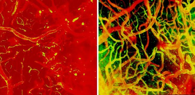 20210119-brain.jpg Image of mouse brain blood vessels one day and ten days after injury