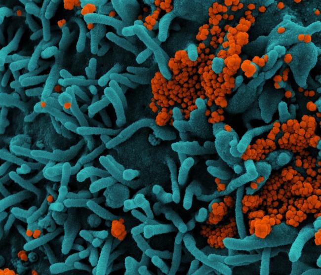 Healthy Human T Cell