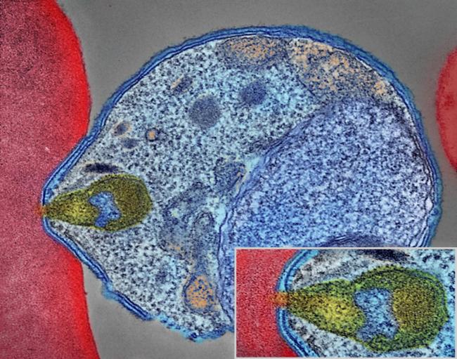 Malaria parasite attaching to human red blood cell