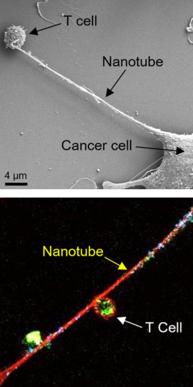 20211207-cancer.jpg Nanotubes between cells