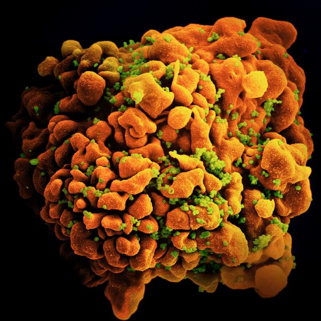 HIV