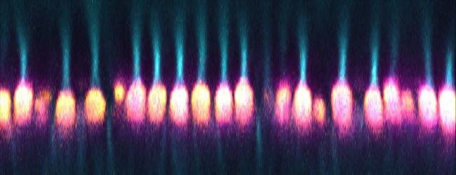 20220302-nei-light-thru-cones.jpg Image of a microscope scan of optical nerves