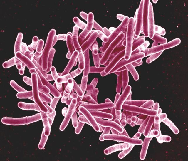 Scanning electron micrograph of Mycobacterium tuberculosis bacteria, which cause TB. 