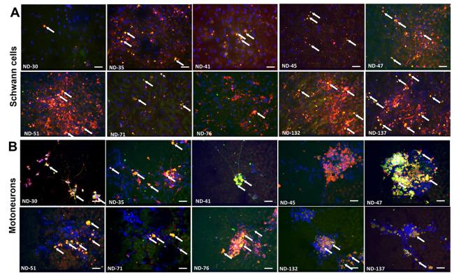20220419-tissue-chips.jpg Antibodies attach to Schwann cells and motoneurons.