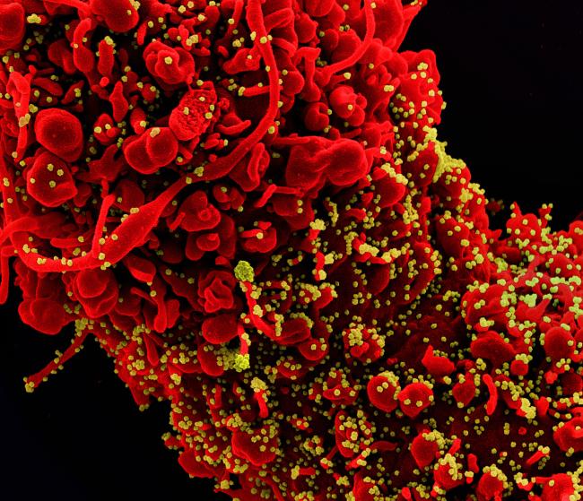 Novel Coronavirus SARS-CoV-2