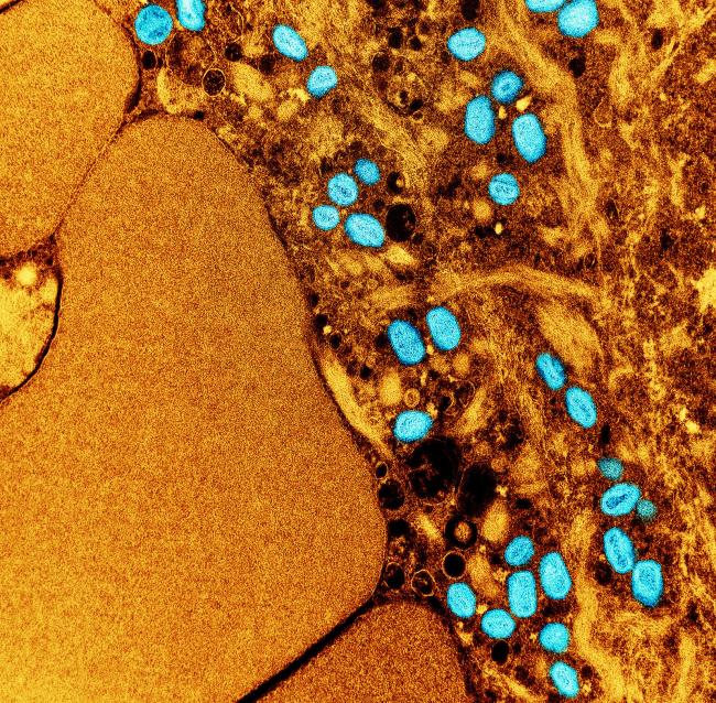 Monkeypox Virus