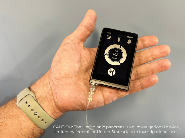 iLet bionic pancreas deviceBeta Bionics