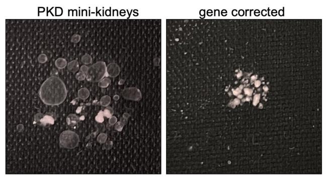Two photos of tissue chips. The one on the left shows mini-kidneys with homozygous PKD mutations, the one on the right shows gene-corrected heterozygotes. 