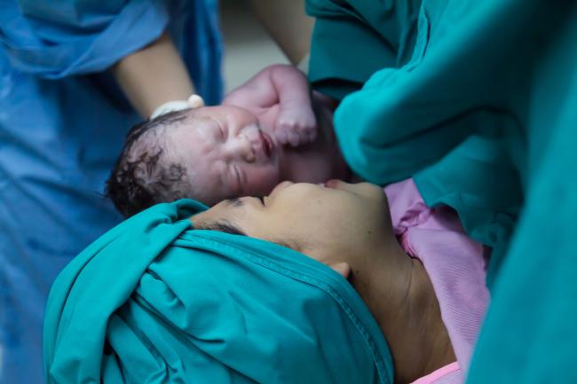 20230425-cesarean.jpg Mom and her newborn first meeting in operation room.