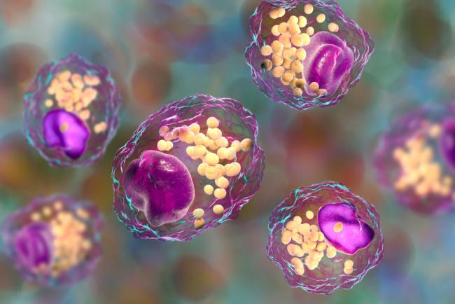 20231024-lipids.jpg Foam cells.