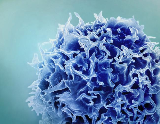 Colorized scanning electron micrograph of a T lymphocyte  (also known as a T cell) (blue). 