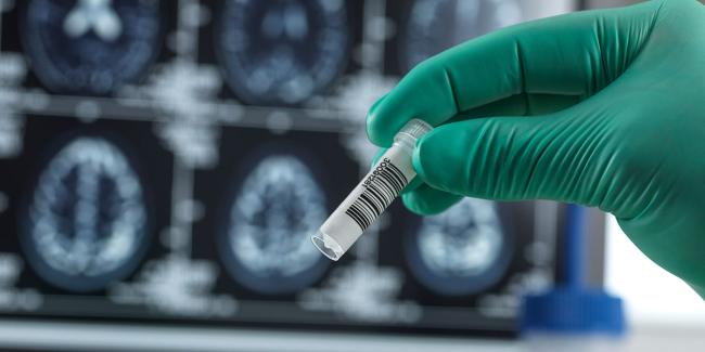 Gloved hand holding a test tube with brain images in background