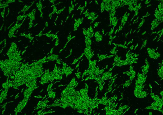 20240416-cholesterol-paper-orig.jpg Microscope image of green, rod-shaped Oscillibacter bacteria.