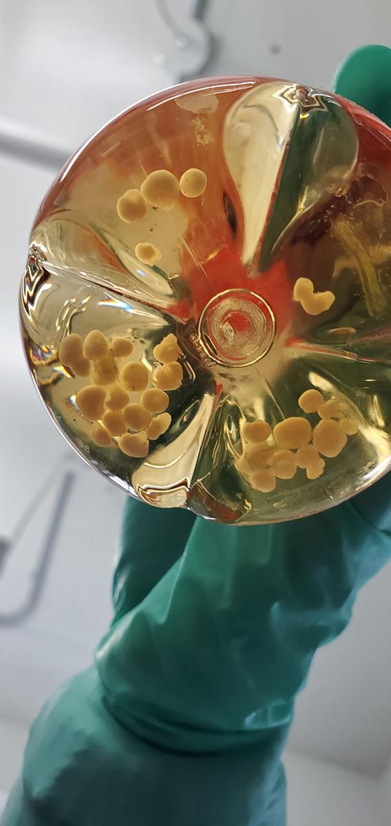 A researcher holds a glass flask containing small spherical human cerebral organoids similar to those used in the CWD study