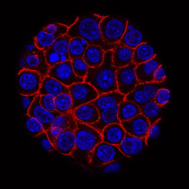 Pancreatic cancer cells