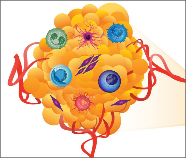 Illustration of a cancer tumor microenvironment