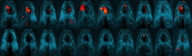 Image of PET-CT lung scans