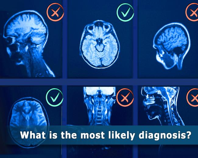 Image of six MRI scans with red Xs or green check marks and the question - Which is the most likely diagnosis