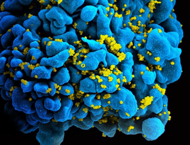 HIV virus