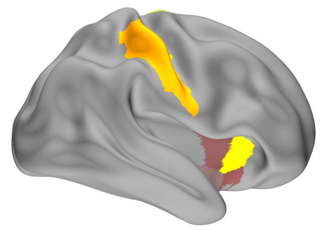 Computer-generated image of a brain