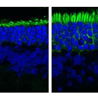 Side-by-side images show untreated, shorter rod photoreceptors next to longer rods treated with reserpine.